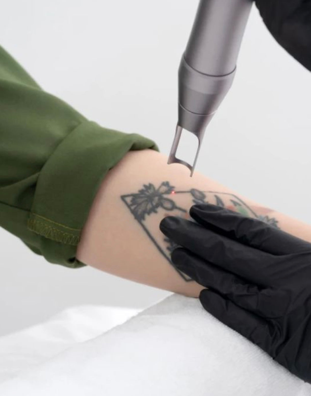 TATTOO REMOVAL COURSE ONLINE