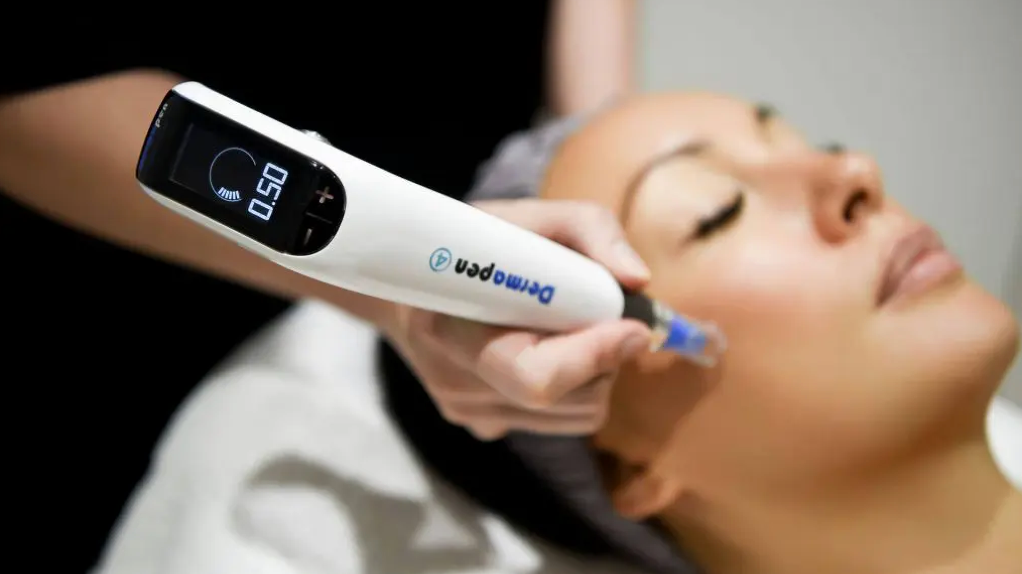 SKIN NEEDLING ONLINE